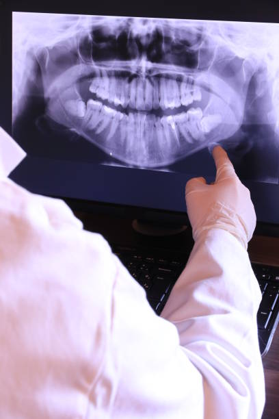 Best Emergency Dental Surgery in Springdale, NJ