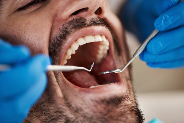 Best Emergency Broken Tooth Repair in Springdale, NJ