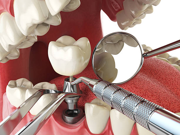 Best Emergency Treatment for Toothache in Springdale, NJ